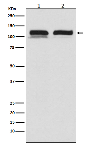Rabbit Polyclonal Antibody to USP11