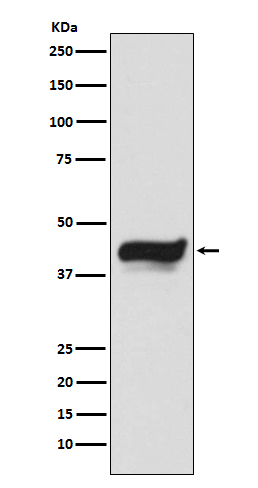 Rabbit Polyclonal Antibody to IKB epsilon