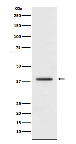 Rabbit Polyclonal Antibody to Macro H2A.1