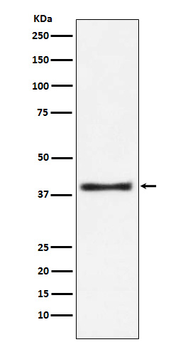 Rabbit Polyclonal Antibody to Aspartate Aminotransferase