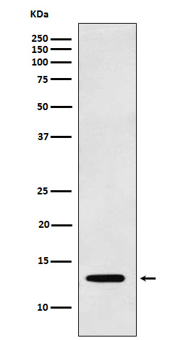 Rabbit Polyclonal Antibody to Galectin 1