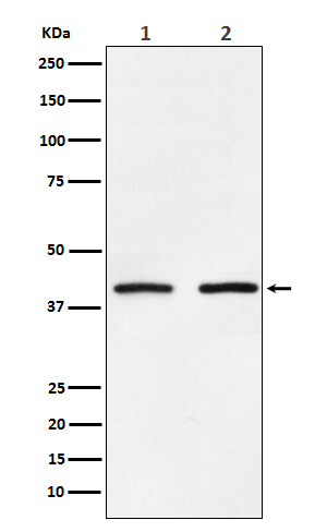 Rabbit Polyclonal Antibody to SMYD3