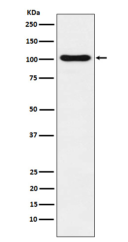 Rabbit Polyclonal Antibody to DNA Ligase IV