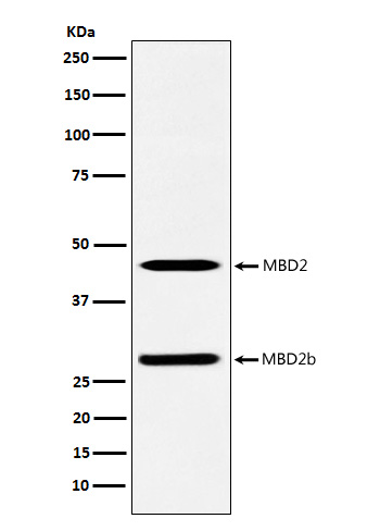 Rabbit Polyclonal Antibody to MBD2