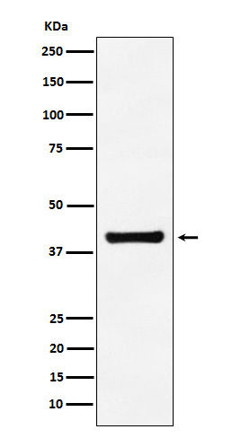 Rabbit Polyclonal Antibody to ALDOA