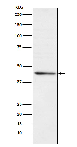 Rabbit Polyclonal Antibody to RRM2
