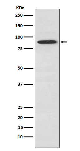 Rabbit Polyclonal Antibody to UBA2