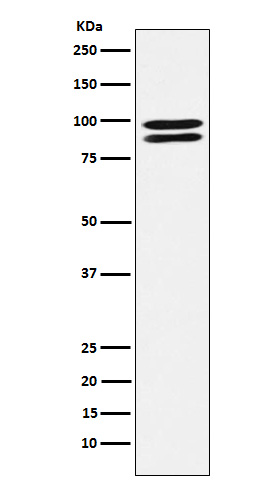 Rabbit Polyclonal Antibody to ALIX