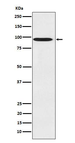 Rabbit Polyclonal Antibody to CDT2