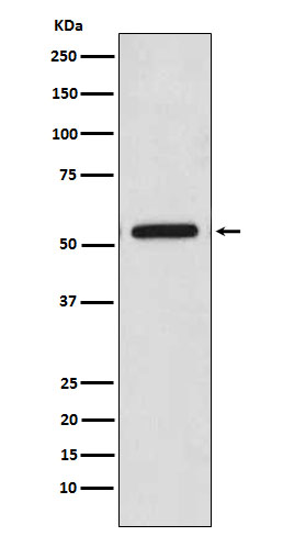 Rabbit Polyclonal Antibody to CaMKII beta