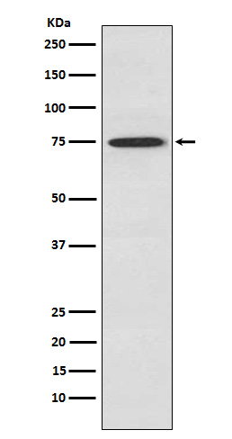 Rabbit Polyclonal Antibody to PKC theta