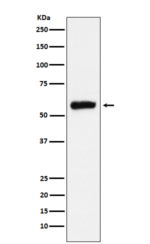 Rabbit Polyclonal Antibody to ALDH2