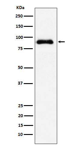 Rabbit Polyclonal Antibody to SATB2