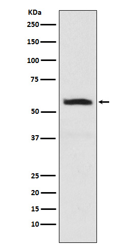 Rabbit Polyclonal Antibody to alpha Internexin