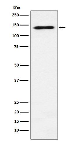 Rabbit Polyclonal Antibody to RNA Helicase A