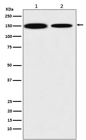 Rabbit Polyclonal Antibody to KDM4A