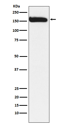 Rabbit Polyclonal Antibody to KAT13A