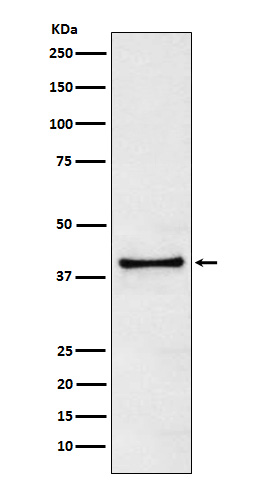 Rabbit Polyclonal Antibody to TRIB3