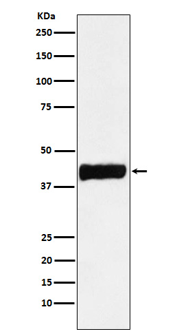 Rabbit Polyclonal Antibody to Creatine Kinase B type