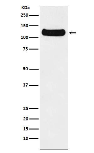 Rabbit Polyclonal Antibody to DDB1