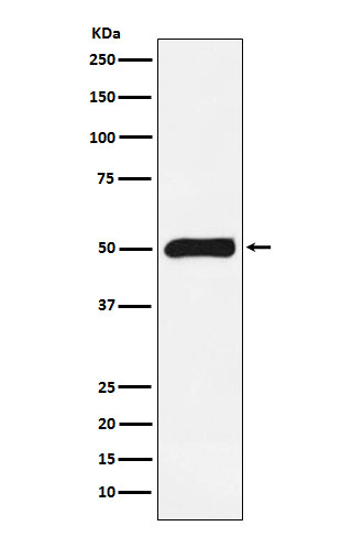 Rabbit Polyclonal Antibody to FKBP51