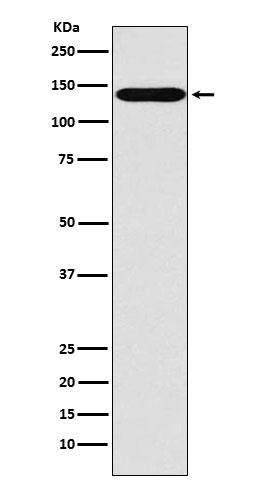 Rabbit Polyclonal Antibody to SLC9A1