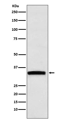 Rabbit Polyclonal Antibody to GDF15