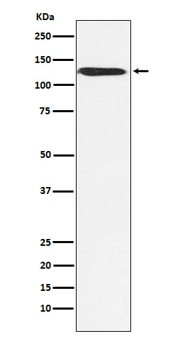 Rabbit Polyclonal Antibody to SMARCA5