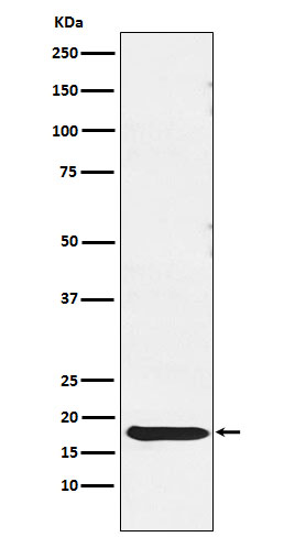 Rabbit Polyclonal Antibody to Thyrotropin Subunit beta