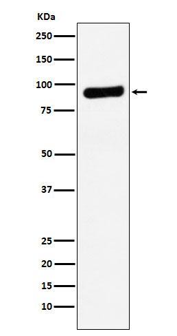 Rabbit Polyclonal Antibody to RRM1