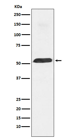 Rabbit Polyclonal Antibody to PTBP1