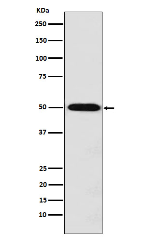 Rabbit Polyclonal Antibody to Monocarboxylic Acid Transporter 1