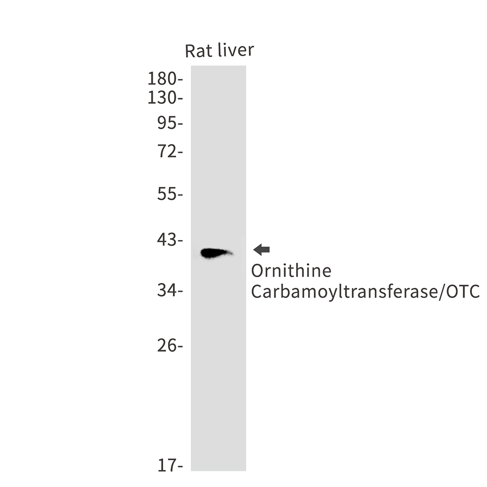 Rabbit Polyclonal Antibody to OTC