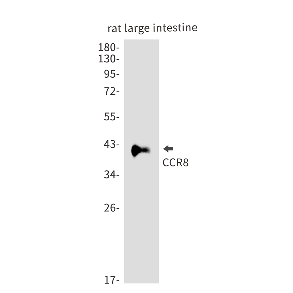 Rabbit Polyclonal Antibody to CCR8