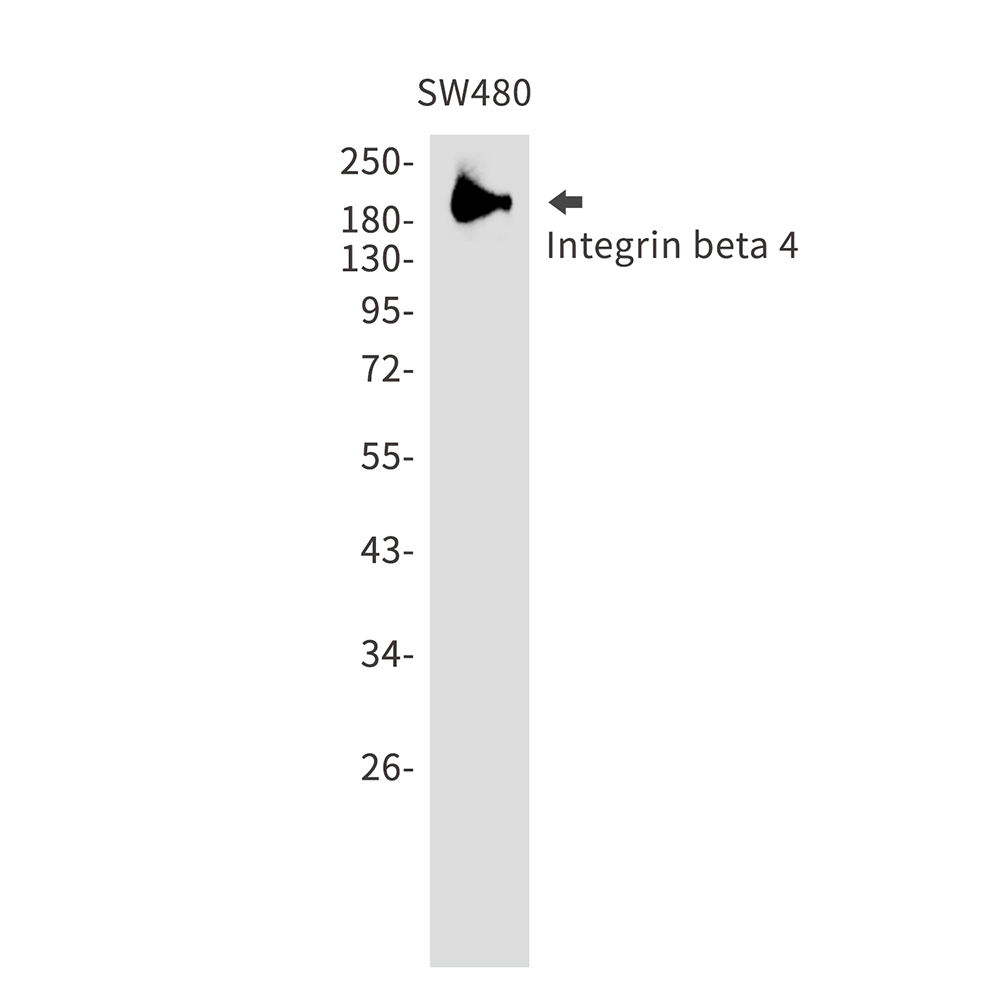 Rabbit Polyclonal Antibody to Integrin beta 4