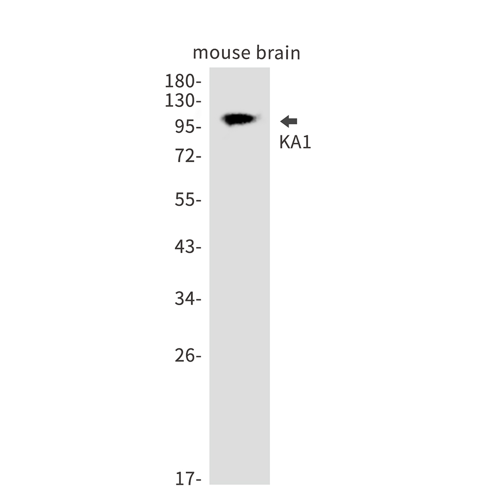 Rabbit Polyclonal Antibody to KA1
