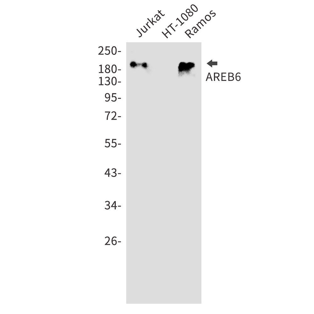 Rabbit Polyclonal Antibody to ZEB1
