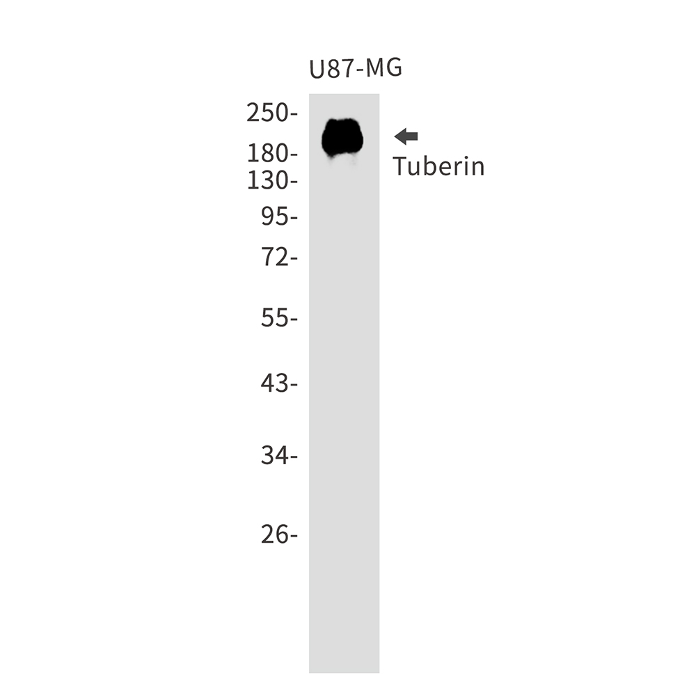 Rabbit Polyclonal Antibody to Tuberin