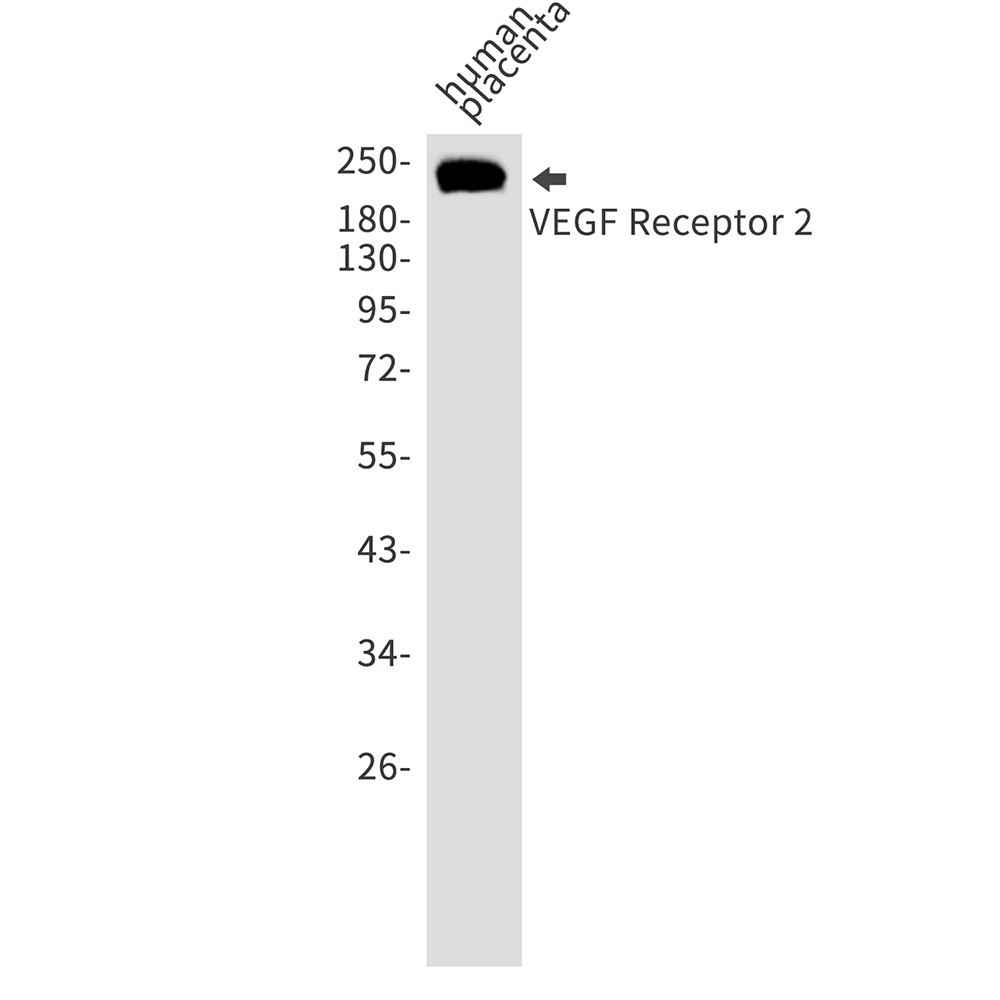 Rabbit Polyclonal Antibody to VEGF Receptor 2
