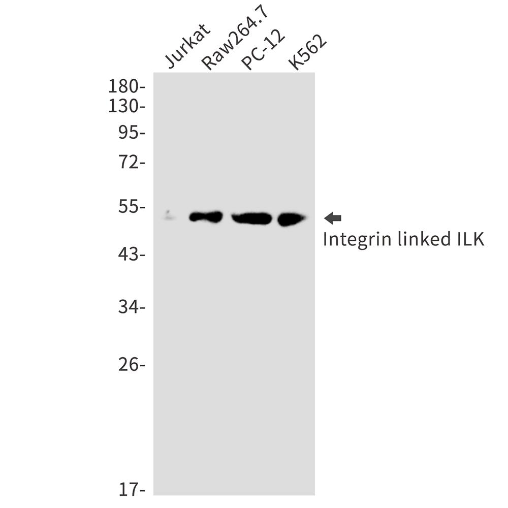 Rabbit Polyclonal Antibody to ILK