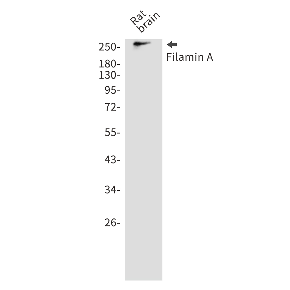 Rabbit Polyclonal Antibody to Filamin A