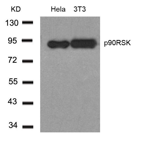Rabbit Polyclonal Antibody to RSK1 p90