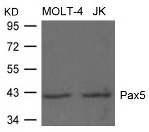 Rabbit Polyclonal Antibody to PAX5