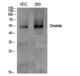 Rabbit Polyclonal Antibody to Desmin