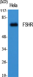 Rabbit Polyclonal Antibody to FSHR