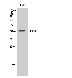 Rabbit Polyclonal Antibody to HuB/HuD