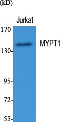 Rabbit Polyclonal Antibody to Myosin Phosphatase