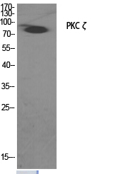 Rabbit Polyclonal Antibody to PKC zeta