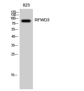 Rabbit Polyclonal Antibody to RFWD3
