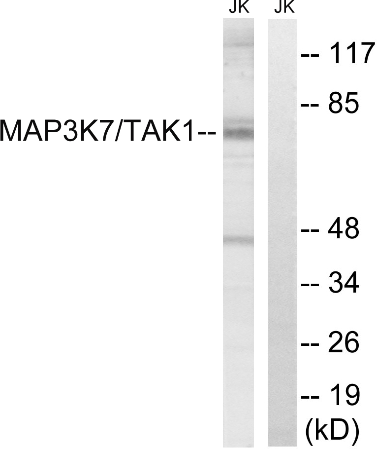 Rabbit Polyclonal Antibody to TAK1